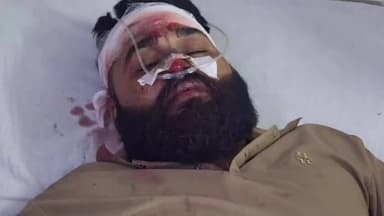 हरदा: हरदा में दो स्थानों पर जमकर हुआ बवाल, दो लोग घायल, जिला अस्पताल में भर्ती