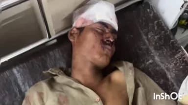कटनी नगर: घंटाघर क्षेत्र में मामूली बात पर युवक पर लोहे की बाल्टी से हमला, घायल ज़िला अस्पताल में भर्ती