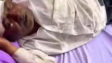 मुलाना: क्वालिटी चौक बराड़ा में एक्टिवा और कार की टक्कर, एक्टिवा चालक घायल