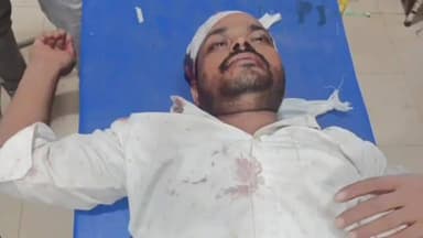 कसिया: कसया-ठेकुआटायर मार्ग पर भीषण सड़क हादसे में बाइक सवार युवक गंभीर रूप से घायल