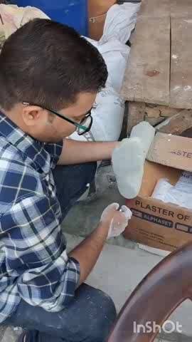 नजीबाबाद: दिव्यांग मुक्त भारत की दिशा में करुणामई पहल: मुस्सेपुर में दो दिवसीय कैंप में बांटे गए कृत्रिम अंग