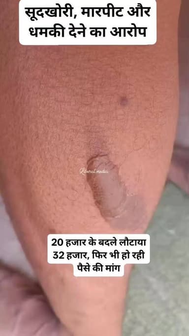 20 हजार के बदले लौटाया 32 हजार, फिर भी हो रही पैसे की मांग, घर पर पहुंचकर किया मारपीट, तीसरे दिन उभांव थाना में हुआ मुकदमा
#बेल्थरारोड #बलिया #उभांव_थाना #गांव_की_खबर #डायल112 #सूदखोरी