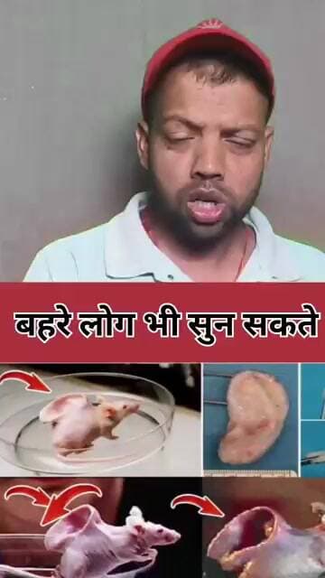 बहरे लोग भी सुन सकते |;™