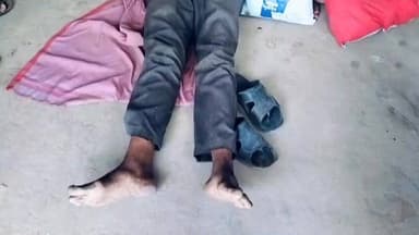 सीएचसी से 100 मीटर दूर तड़पता रहा मरीज, स्वास्थ्य व्यवस्था पर उठे सवाल
पत्नी का आरोप: भर्ती नहीं किया, बाहर जांच कराने को कहा
वायरल वीडियो के बाद स्वास्थ्य विभाग की कार्यशैली चर्चा में
रिपोर्ट राजेश सोनकर
प्रयागराज के जसरा स्थित सामुदायिक स्वास्थ्य केंद्र (सीएचसी) से जुड़ा एक मामला सोशल मीडिया पर चर्चा का विषय बना हुआ है। आरोप है कि गंभीर हालत में अस्पताल पहुंचे एक मरीज को तत्काल भर्ती नहीं किया गया, जिसके बाद वह अस्पताल से कुछ दूरी पर सड़क किनारे घंटों तक तड़पता रहा। घटना का वीडियो सामने आने के बाद स्वास्थ्य सेवाओं की उपलब्धता और अस्पताल प्रबंधन को लेकर सवाल उठने लगे हैं। हालांकि अस्पताल प्रशासन ने आरोपों से इनकार करते हुए अपना पक्ष भी रखा है।
सीएचसी जसरा के बाहर सड़क किनारे पड़ा रहा मरीज
प्राप्त जानकारी के अनुसार, प्रयागराज जनपद के कचरा मानपुर गांव निवासी 56 वर्षीय राकेश शुक्ला की तबीयत बिगड़ने पर उनकी पत्नी कमल शुक्ला उन्हें मंगलवार सुबह सामुदायिक स्वास्थ्य केंद्र जसरा लेकर पहुंचीं। परिजनों का आरोप है कि चिकित्सकीय जांच के बाद मरीज को भर्ती करने के बजाय कुछ दवाइयां और अल्ट्रासाउंड जांच लिखकर बाहर भेज दिया गया।
पीड़िता का कहना है कि चिकित्सकों द्वारा बताया गया कि अस्पताल में अल्ट्रासाउंड की सुविधा उपलब्ध नहीं है और जांच बाहर से करानी होगी। आर्थिक तंगी के कारण वह निजी जांच कराने में असमर्थ थीं।
तीन घंटे तक मदद की गुहार लगाती रही पत्नी
परिजनों के अनुसार अस्पताल से बाहर निकलते ही राकेश शुक्ला की तबीयत और बिगड़ गई। उनकी पत्नी उन्हें अस्पताल से लगभग 100 मीटर दूर सड़क किनारे स्थित एक टीनशेड के नीचे लिटाकर सहायता मांगती रहीं।
प्रत्यक्षदर्शियों के मुताबिक मरीज करीब तीन घंटे तक वहीं पड़ा रहा। बाद में स्थानीय लोगों ने मानवता दिखाते हुए मरीज को दोबारा अस्पताल पहुंचाया और भर्ती कराया।
घटना का वीडियो सोशल मीडिया पर वायरल होने के बाद लोगों में नाराजगी देखी जा रही है और स्वास्थ्य विभाग की कार्यप्रणाली पर सवाल उठाए जा रहे हैं।
पत्नी ने लगाए गंभीर आरोप
कमल शुक्ला का कहना है कि यदि उनके पास निजी इलाज और जांच कराने के लिए पर्याप्त धन होता तो उन्हें सरकारी अस्पताल का सहारा नहीं लेना पड़ता। उनका आरोप है कि समय रहते समुचित उपचार और भर्ती की व्यवस्था होती तो उन्हें इस स्थिति का सामना नहीं करना पड़ता।
अस्पताल प्रशासन ने दी सफाई
मामले में सीएचसी जसरा के कार्यवाहक अधीक्षक डॉ. सुरेश प्रसाद ने बताया कि मरीज प्रोस्टेट संबंधी समस्या से पीड़ित था। प्रारंभिक जांच के बाद दवाइयां दी गईं और आगे की जांच के लिए स्वरूपरानी अस्पताल भेजा गया था।
उन्होंने कहा कि मरीज स्वयं अस्पताल परिसर से बाहर गया था। अस्पताल प्रशासन ने भर्ती न करने के आरोपों को खारिज करते हुए कहा कि आवश्यकता होने पर मरीज पुनः चिकित्सकीय परामर्श ले सकता था। वायरल पर्चे पर कथित रूप से लिखे गए "रेफर" संबंधी बिंदु पर उन्होंने कहा कि दस्तावेज देखने के बाद ही स्पष्ट टिप्पणी की जा सकती है।
वायरल फैक्ट
घटना का वीडियो सोशल मीडिया प्लेटफॉर्म पर तेजी से वायरल हो रहा है। वीडियो में मरीज सड़क किनारे लेटा दिखाई दे रहा है, जबकि उसकी पत्नी सहायता की गुहार लगाती नजर आ रही है। वीडियो सामने आने के बाद आम नागरिकों ने सरकारी स्वास्थ्य सेवाओं की गुणवत्ता और संवेदनशीलता पर सवाल उठाए हैं।
यह मामला केवल एक मरीज की पीड़ा तक सीमित नहीं है, बल्कि ग्रामीण और आर्थिक रूप से कमजोर वर्गों के लिए स्वास्थ्य सेवाओं की पहुंच और संवेदनशीलता पर व्यापक चर्चा को जन्म देता है। जहां एक ओर परिजन लापरवाही के आरोप लगा रहे हैं, वहीं अस्पताल प्रशासन अपने स्तर पर उपचार उपलब्ध कराने की बात कह रहा है। अब लोगों की निगाहें इस बात पर टिकी हैं कि मामले की जांच में क्या तथ्य सामने आते हैं और जिम्मेदारी किसकी तय होती है।
ND NEWS की अपील
🔹 सरकारी अस्पतालों में आने वाले प्रत्येक गंभीर मरीज की प्राथमिकता के आधार पर जांच और उपचार सुनिश्चित किया जाए।
🔹 आर्थिक रूप से कमजोर मरीजों को उपलब्ध सरकारी सुविधाओं की स्पष्ट जानकारी दी जाए।
🔹 स्वास्थ्य संस्थानों में मानवता और संवेदनशीलता को सर्वोच्च प्राथमिकता दी जाए।
🔹 जिला प्रशासन ऐसे मामलों की निष्पक्ष जांच कर जनता का विश्वास मजबूत करे।
🔹 मरीज और परिजन भी किसी गंभीर स्थिति में तत्काल 108 एम्बुलेंस एवं संबंधित अधिकारियों से संपर्क करें।
ND NEWS संदेश:
"स्वास्थ्य सेवा केवल व्यवस्था नहीं, बल्कि मानव जीवन के प्रति जिम्मेदारी और संवेदनशीलता का सबसे बड़ा दायित्व है।"
👇👇👇
#NDNews
#दैनिकनिष्पक्षधारा
#PrayagrajNews
#JasraCHC
#HealthDepartment
#Healthcare
#PatientCare
#Prayagraj
#UPHealth
#CHCJasra
#DrSureshPrasad
#NDNewsChannel
👇👇
👇👇👇👇
@dgpup
@UPGovt
@RSSorg
@Uppolice
@wpl1090
@RSSgeet
@MIB_India
@PMOIndia
@HMOIndia
@VHPDigital
@CMOUP_RC
@myogioffice
@InfoDeptUP
@CMOfficeUP
@UPPRD1948
@ChiefSecyUP
@MahantYogiG
@ChiefSecyUP
@BajrangDalOrg
@myogiadityanath
@112UttarPradesh
@UPPViralCheck
@UpPolicemitra
@prayagraj_pol
@ADGZonPrayagraj
@DM_PRAYAGRAJ
@CommissionerPrg
@NigamPrayagraj
@Prayagraj_TP
@PROdefprayagraj
👇👇
🟥 ND NEWS | दैनिक निष्पक्ष धारा
मुख्य संपादक / संस्थापक: राजन सिंह हाड़ा
सह-संपादक: शालिनी सिंह भदौरिया
📍 कार्यालय-3: U158, हीरा स्वीट्स के पास, विकास मार्ग, लक्ष्मी नगर, पूर्वी दिल्ली, पिन कोड – (110092) (NCR)
📍 कार्यालय-2: विधानसभा रोड, बर्लिंगटन चौराहा, लखनऊ (226001) (UP)
📍 कार्यालय-1: 1/1 अटल बिहारी चौराहा, नियर बर्मा चौराहा, फतेहपुर (212601) (UP)
📅 दिनांक: 09 जून 2026
📆 दिन: मंगलवार
📧 Email: ndnewschannel@gmail.com
📞 मोबाइल: 9696119696
👇👇👇
अस्वीकरण: यह समाचार उपलब्ध शिकायतों, प्रत्यक्षदर्शियों के कथनों तथा संबंधित पक्षों के बयानों पर आधारित है। मामले की जांच और आधिकारिक रिपोर्ट के आधार पर तथ्यों में परिवर्तन संभव है।