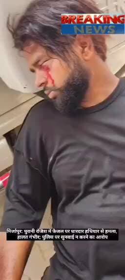 हमले में युवक को आई गंभीर चोटें, ईलाज के लिए मंडलीय अस्पताल रेफर, पीड़ित के अनुसार स्थानीय पुलिस ने मामले में नहीं बरती