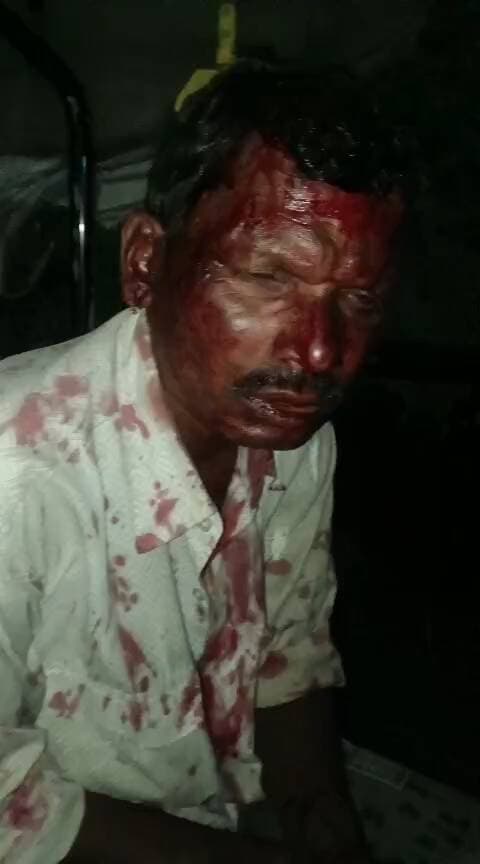 अशोकनगर के अंतर गत एक घटना सामने आई हे दिनांक 17/06/2026 को रात 12 बजे हुई भयानक लड़ाई मुंगावली पुलिस रिपोर्टनहीं लिखा