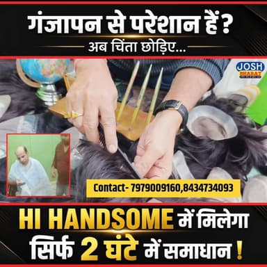 गं/जा पन से परेशान लोगों को Hi Handsome क्या बोले ...
#HIHandsome #HairPatch #HairReplacement #HairTransformation #LatestNews