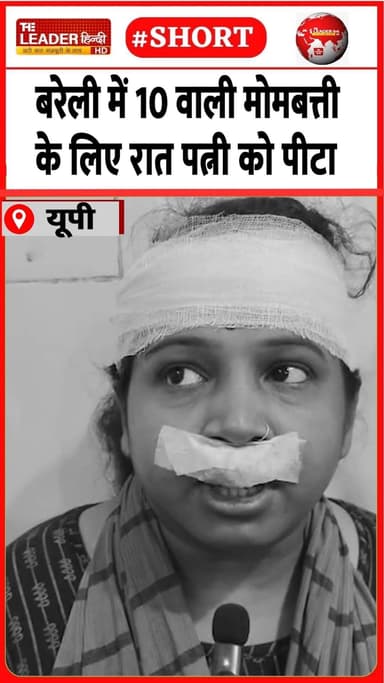 सिर से लेकर होंठ तक ज़ख़्मी | 22 june 2026 #bareilly #fight #police #shorts