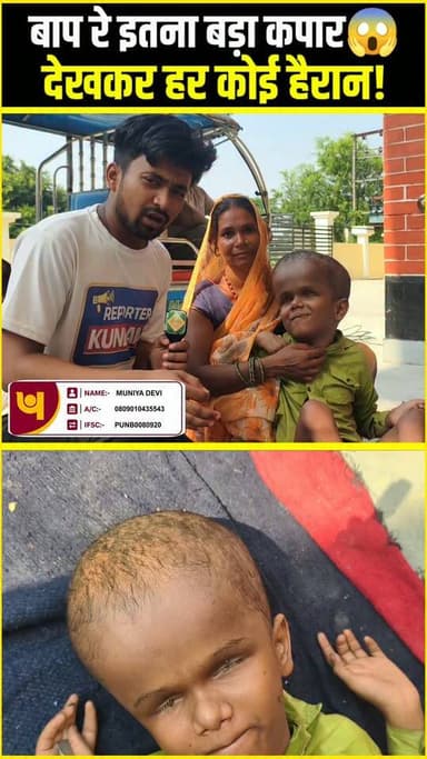 बाप रे इतना बड़ा कपार😱देखकर हर कोई हैरान!#Hydrocephalus #RareDisease #ChildHealth #MedicalCase #ViralPhoto #Humanity #HelpNeeded #Awareness #Trending #InspiringStory #India #HealthAwareness #Support #NewsUpdate #ViralNews