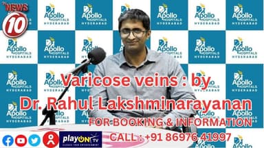 Varicose veins : by Dr. Rahul Lakshminarayanan, Vascular & Endovascular Surgeon || #VaricoseVeins #VeinHealth #HealthyLegs #VascularCare #VascularSurgery #LegPain #LegSwelling #ChronicVenousInsufficiency #SpiderVeins #BloodCirculation #HealthAwareness #PreventVaricoseVeins #DrRahulLakshminarayanan #ExpertCare #MedicalEducation #Healthcare #Wellness #EarlyDiagnosis #MinimallyInvasiveTreatment #HealthyLiving #tvnews10 #Durgapur #DurgapurNews #বাংলার_খবর #BreakingNews #TVNews10 #followerseveryone #followers #tvnews10 #localnews #follower #TMC #BJPNEWS #WestBengal #BreakingNews #LiveUpdate #BengalNews || https://public.app || www.tvnews10.com