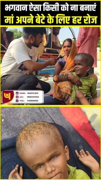 भगवान ऐसा किसी को ना बनाएं !!😱!! #viralphoto #hydrocephalus #NewsUpdate #humanity #india #viralnews #trending #support #awareness