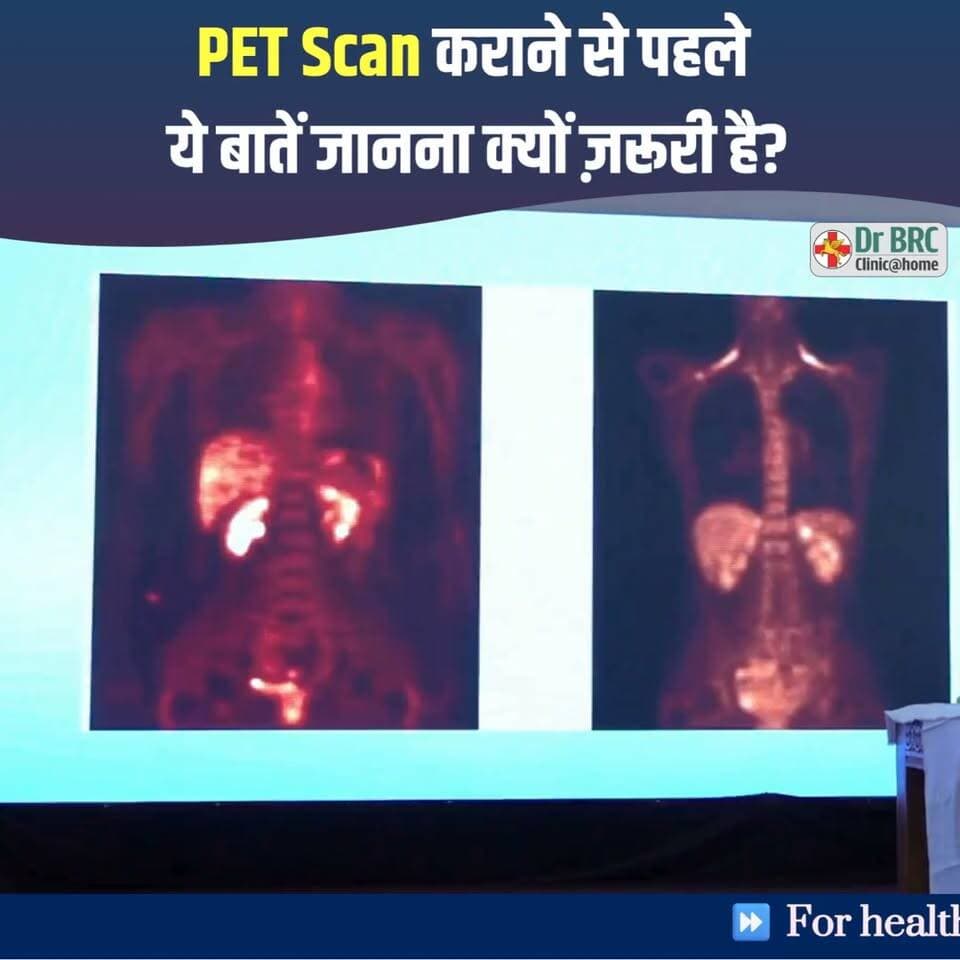 PET Scan कराने से पहले ये बातें जानना क्यों ज़रूरी है? - Dr. Biswaroop Roy Chowdhury
Helpline Number: 9312286540
#PETScan #HealthEducation #MedicalAwareness #DrBRC #DrBiswaroopRoyChowdhury