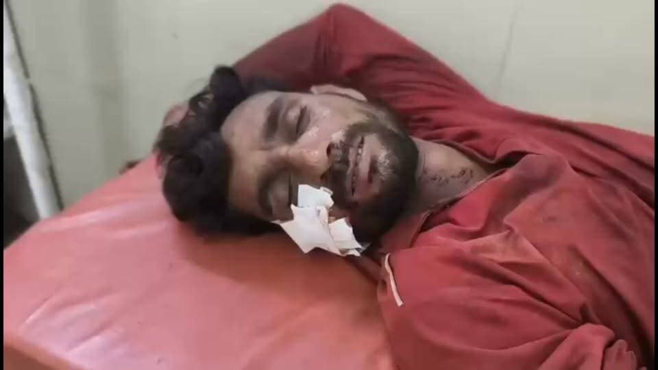 आरोपी चालक गिरफ्तार
#HitAndRun #TruckAccident #Mohla #Manpur #ChhattisgarhNews #BreakingNews #RoadAccident #PoliceChase #CGVoiceNews #LatestNews #CrimeNews #ViralVideo #Highway #IndiaNews #TrendingNews