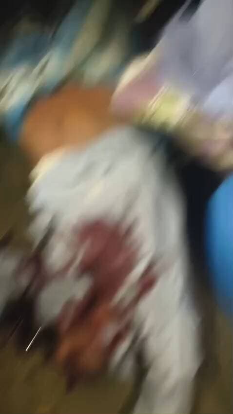 Jharkhand jila Sahibganj rajmahal road ka accident Hai teen aadami khatm ho chuka hai aur Gambhir Roop se Ghayal hai