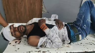 🚨 बैतूल ऑयल मिल के पास भीषण सड़क हादसा!
💥 दो बाइकों की आमने-सामने टक्कर, दो युवक घायल
⚠️ एक की हालत बेहद गंभीर, जिला अस्पताल में इलाज जारी
बैतूल शहर के कोतवाली थाना क्षेत्र अंतर्गत इटारसी रोड स्थित बैतूल ऑयल मिल के पास गुरुवार रात करीब 9:30 बजे दो बाइकों के बीच जोरदार भिड़ंत हो गई। टक्कर इतनी भीषण थी कि दोनों बाइक सवार सड़क पर गिरकर गंभीर रूप से घायल हो गए।
घायलों की पहचान चिचोली क्षेत्र के 27 वर्षीय जमना प्रसाद और 23 वर्षीय राजेश यादव के रूप में हुई है। हादसे में राजेश यादव की हालत अत्यधिक गंभीर बताई जा रही है, जबकि दोनों का उपचार जिला चिकित्सालय बैतूल में जारी है।
सूचना मिलते ही पुलिस और स्थानीय लोग मौके पर पहुंचे तथा घायलों को तत्काल अस्पताल पहुंचाया। पुलिस ने मामला दर्ज कर हादसे के कारणों की जांच शुरू कर दी है।
🙏 वाहन चलाते समय सावधानी बरतें, हेलमेट पहनें और यातायात नियमों का पालन करें।
#Betul #BetulNews #BreakingNews #RoadAccident #BikeAccident #MadhyaPradesh #KotwaliBetul #Chicholi #MPNews #HindiNews #TrendingNews #ViralNews #NewsUpdate #RoadSafety #StaySafe