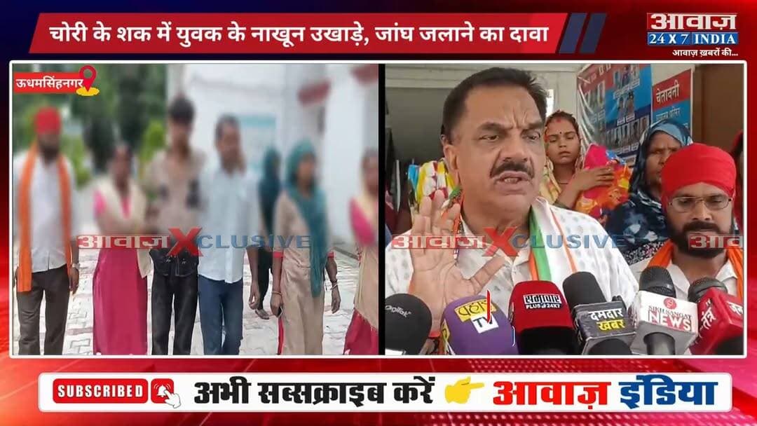 #रुद्रपुर #पुलिस पर थ#र्ड डि#ग्री का गं#भीर आ#रो#प! चो#री के श#क में युवक ने किया टॉ#र्चर का दावा! नि#ष्पक्ष जां#च की उठी मां#ग
#AwaazIndiaNational #Uttarakhand #Rudrapur #Congress #RajKumarThukral #UdhamSinghNagarPolice #latestnews