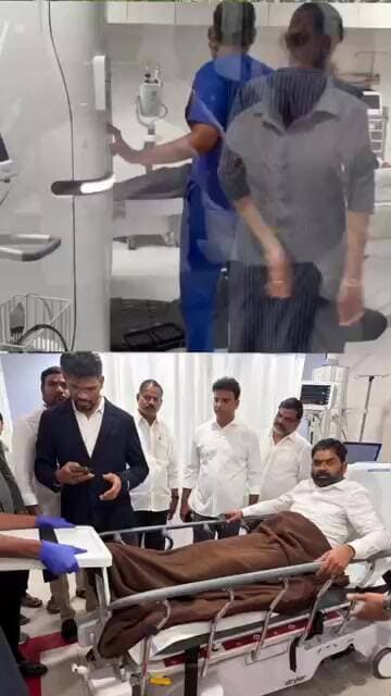 వరంగల్ పర్యటనలో ఎమ్మెల్సీ శంబిపూర్ రాజుకు స్వల్ప గాయాలు.