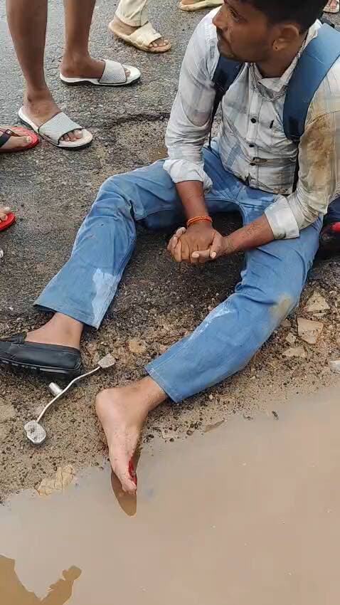 तिजारा के पास बिजली गिरने से 2 लोग घायल हो गए
#तिजारा@