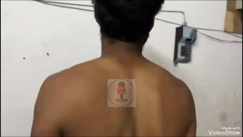 तस्करी के शक में युवक की बेरहमी से पिटाई, मोकामा आरपीएफ के ASI निलंबित
मोकामा (पटना): पटना जिले के मोकामा आरपीएफ पोस्ट से जुड़ा एक बेहद गंभीर मामला सामने आया है, जहाँ शराब तस्करी के महज संदेह में एक युवक की बर्बरतापूर्वक पिटाई करने का आरोप लगा है। इस मामले में त्वरित कार्रवाई करते हुए विभाग ने आरोपित असिस्टेंट सब-इंस्पेक्टर (ASI) को सस्पेंड कर दिया है।
पीड़ित युवक की पहचान मोकामा नगर के वार्ड संख्या-सात, डॉक्टर टोली निवासी शंकर चौधरी के पुत्र चंदन कुमार के रूप में हुई है। चंदन का आरोप है कि तीन दिन पहले मंगलवार की देर रात करीब दो बजे, जब वह मोकामा पूर्वी समपार फाटक के पास से गुजर रहा था, तभी वहाँ गश्त कर रहे आरपीएफ एएसआइ पप्पू यादव ने उसे रोक लिया।
आरोप है कि एएसआइ ने चंदन पर शराब तस्करी का शक जताया और उसे जबरन पास की झाड़ियों में ले गए। वहाँ लाठियों से उसकी बेरहमी से पिटाई की गई। बर्बरता यहीं नहीं रुकी; पिटाई के बाद घायल और लहूलुहान हालत में युवक को रेलवे एक्ट के एक मामले में आरपीएफ हाजत में बंद कर दिया गया। पीड़ित का कहना है कि उसे गंभीर चोटें आई थीं, लेकिन पूरी रात उसे बिना किसी इलाज के हाजत में तड़पने के लिए छोड़ दिया गया।
हालत बिगड़ने पर कराया अस्पताल में भर्ती
अगले दिन जब चंदन की तबीयत अत्यधिक बिगड़ने लगी, तब आरपीएफ ने उसे हाजत से रिहा किया। घर पहुँचने पर उसकी हालत और ज्यादा खराब हो गई, जिसके बाद चिंतित परिजनों ने उसे तुरंत मोकामा ट्रामा सेंटर में इलाज के लिए भर्ती कराया। होश में आने और स्थिति में थोड़ा सुधार होने के बाद पीड़ित युवक ने मोकामा रेल थाना में आरोपित एएसआइ पप्पू यादव के खिलाफ लिखित शिकायत दर्ज कराई।
मामले की गंभीरता को देखते हुए दानापुर आरपीएफ के वरिष्ठ मंडल सुरक्षा आयुक्त (Sr. DSC) उदय सिंह पवार ने तुरंत संज्ञान लिया। उन्होंने बताया कि मामले की विभागीय जांच शुरू कर दी गई है। प्रथम दृष्टया आरोपों को बेहद गंभीर पाते हुए आरोपित एएसआइ पप्पू यादव को तत्काल प्रभाव से निलंबित (सस्पेंड) कर दिया गया है और उन्हें झाझा स्थित आरपीएफ एसी (Assistant Comandant) कार्यालय से संबद्ध (अटैच) कर दिया गया है। अधिकारियों का कहना है कि विस्तृत जांच रिपोर्ट सामने आने के बाद कानून के मुताबिक आगे की सख्त कार्रवाई की जाएगी।
#Mokama #AnantSingh #viralvideoシ #rail #bihar #patna #railway