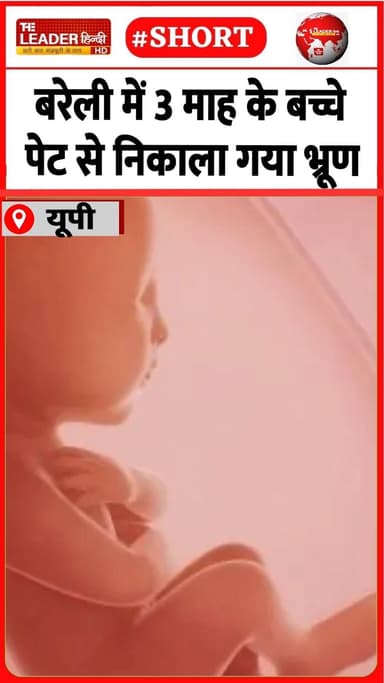 रामपुर गार्डन के हास्पिटल में आपरेशन | 12 July 2026 #bareilly #child #hospital #bhoor #specialcase #shorts