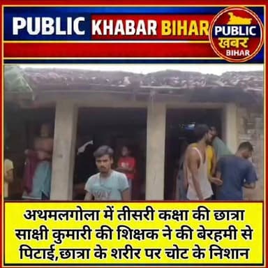 #अथमलगोला में तीसरी कक्षा की छात्रा साक्षी कुमारी की शिक्षक ने की बेरहमी से पिटाई,छात्रा के शरीर पर चोट के निशान,SDM ने दिए जाँच के आदेश।