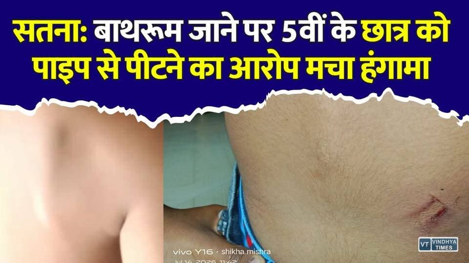 सतना: निजी स्कूल में छात्र से मारपीट का आरोप, शरीर पर चोट के निशान देख भड़के परिजन
#Satna #SatnaNews #SchoolNews #StudentAssault #SchoolViolence #MadhyaPradesh #MPNews #BreakingNews #Education #PoliceInvestigation #HindiNews #ChildSafety #ViralNews #Justice #VindhyaTimes