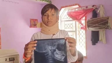 #बेहद_चिंताजनक_खबर..
भरतपुर। जिले के रुदावल थाना क्षेत्र के भवनपुरा गांव से एक हैरान करने वाला मामला सामने आया है, जहां राजकीय आदर्श सीनियर सेकेंडरी स्कूल में घुसकर एक महिला ने सातवीं कक्षा के छात्र देवराज पुत्र सुकलाल की बेरहमी से पिटाई कर उसे गंभीर रूप से घायल कर दिया। स्कूल स्टाफ की लापरवाही के चलते महिला आसानी से स्कूल परिसर के अंदर दाखिल हो गई और वारदात को अंजाम दे दिया। शनिवार को हुई इस घटना के बाद घायल छात्र को तुरंत रुदावल अस्पताल ले जाया गया, जहां से उसकी नाजुक हालत को देखते हुए उसे भरतपुर रेफर कर दिया गया। पीड़ित छात्र का अस्पताल में इलाज चल रहा है। वहीं, स्कूल के भीतर बच्चों की सुरक्षा पर उठे इस बड़े सवाल के बाद पुलिस ने मामला संज्ञान में आते ही जांच शुरू कर दी है।
