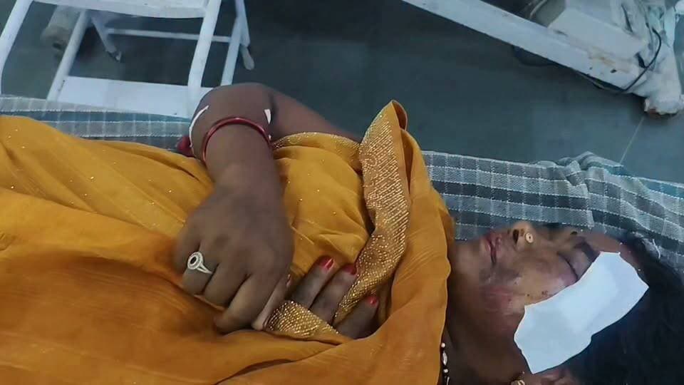 🚨 बैतूल में सड़क के गड्ढे ने फिर ली बड़ी कीमत!
चिचोली थाना क्षेत्र में गहरे गड्ढे से टकराकर बाइक अनियंत्रित हुई, पीछे बैठी महिला सड़क पर गिरकर गंभीर घायल हो गई। प्राथमिक उपचार के बाद जिला अस्पताल में इलाज जारी है। आखिर कब सुधरेंगी जर्जर सड़कें और कब थमेंगे ऐसे हादसे?
#बैतूल #Betul #Chicholi #RoadAccident #सड़क_हादसा #गड्ढों_का_खतरा #BreakingNews #MadhyaPradesh #MPNews #DistrictHospital #RoadSafety #SaveLives #LocalNews #BetulNews #NewsUpdate #ViralNews #सड़क_सुरक्षा #चिचोली #मध्यप्रदेश #हादसा