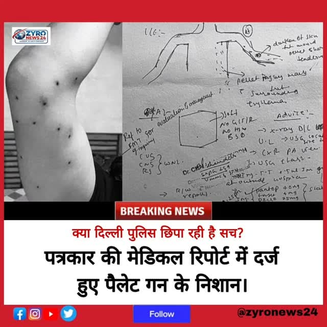 मेडिकल रिपोर्ट में छर्रे, पुलिस का इनकार! 🚨
जंतर-मंतर पर छात्रों के प्रदर्शन के दौरान आउटलुक के पत्रकार को पैलेट गन के छर्रे लगे हैं। मेडिकल रिकॉर्ड में घाव दर्ज होने के बावजूद दिल्ली पुलिस किसी भी तरह के हथियार के इस्तेमाल से इनकार कर रही है।
पुलिस के दावों और मेडिकल रिपोर्ट के इस विरोधाभास पर आप क्या सोचते हैं? अपनी राय कमेंट बॉक्स में जरूर दें। 👇
#DelhiPolice #JantarMantar #ZyroNews24 #Journalist #ProtestNews