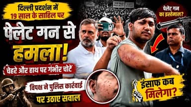 दिल्ली प्रदर्शन में 19 वर्षीय साहिल घायल होने का आरोप, विपक्ष ने पुलिस कार्रवाई पर उठाए सवाल | #DelhiProtest #Sahil #DelhiPolice #PelletGun #BreakingNews #StudentProtest #Politics #HindiNews Er Rana Pratap Singh Anirudha Mishra Rahul Gandhi