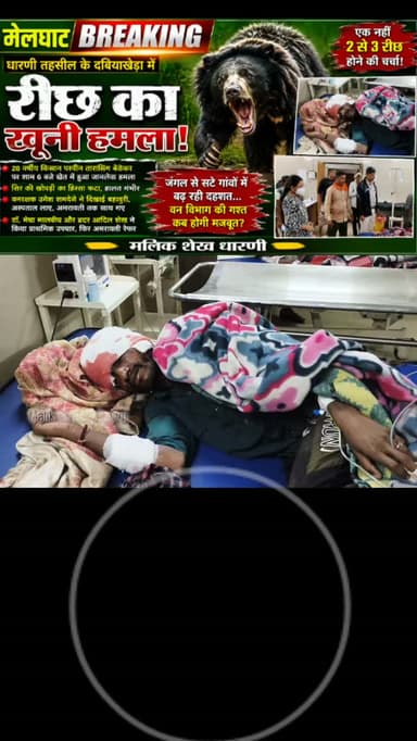 मेलघाट में रीछ का खूनी हमला!
दबियाखेड़ा में खेत के धूरे में पशु चरा रहे 28 वर्षीय किसान पर जानलेवा हमला, सिर पर गंभीर चोट...
अमरावती रेफर
आखिर जंगल से सटे गांवों की सुरक्षा कब होगी?
पूरा वीडियो देखें
#Melghat #Dharni #BearAttack #BreakingNews #accident
