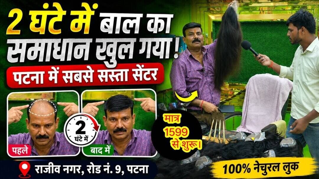 आपके बाल का समाधान पटना में होगा मात्र 2 घंटे में !! #trending #hairstyle #patna #HairCare #viral
