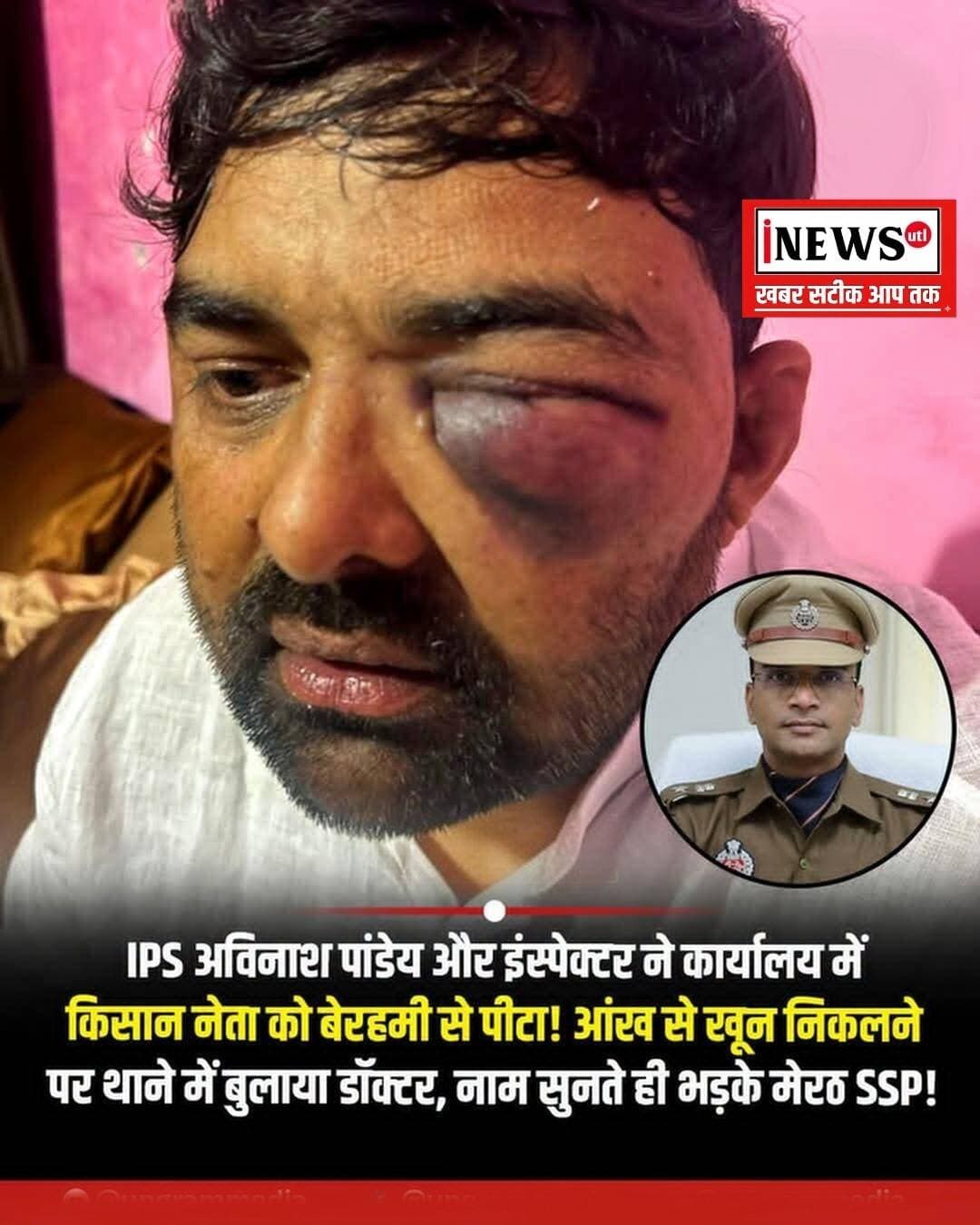 IPS अविनाश पांडेय और इंस्पेक्टर ने कार्यालय में किसान नेता को बेरहमी से पीटा! आंख से खून निकलने पर थाने में बुलाया डॉक्टर, नाम सुनते ही भड़के मेरठ SSP!
उत्तर प्रदेश के मेरठ के एसएसपी अविनाश पांडेय और सिविल लाइंस थाने के प्रभारी अखिलेश गौड़ पर गंभीर आरोप लगे हैं। भारतीय किसान यूनियन के बीआर आंबेडकर के अध्यक्ष डॉ. दिग्विजय भाटी और उनके साथी मोहित जाटव ने पिटाई करने के गंभीर आरोप लगाए हैं। वहीं, गुरुवार रात अविनाश पांडेय मेरठ एसएसपी के पद से हटा दिए गए। उनको डीजीपी मुख्यालय लखनऊ में एसपी पद पर संबंद्ध कर दिया गया है।
किसान नेता दिग्विजय भाटी ने आरोप लगाते हुए बताया कि बुधवार रात उनको सिविल लाइंस थाने ले जाया गया। यहां पर मेडिकल के बाद परिजनों के हवाले कर दिया। दिग्विजय भाटी ने आरोप लगाया कि वह अपने साथी मोहित जाटव के साथ गैंगस्टर के एक मुकदमे में निष्पक्ष जांच के लिए मेरठ एसएसपी के कार्यालय में गए हुए थे। उस समय एसएसपी अविनाश पांडेय कार्यालय में नहीं थे। उनके पहुंचने के 5 मिनट बाद एसएसपी अविनाश पांडेय आ गए।
दिग्विजय भाटी ने आरोप लगाया कि एसएसपी अविनाश पांडेय ने एक सिपाही को अंदर बुलाया। दोनों ने अपना परिचय दिया। आरोप है कि दिग्विजय भाटी का नाम सुनते ही एसएसपी अविनाश पांडेय आग बबूला हो गए और भड़कते हुए कहा कि तुम वही हो, जिसने कलेक्ट्रेट गेट पर हंगामा किया था। इसके बाद कार्यालय में एसएसपी ने दोनों को पीटा। फिर सिविल लाइंस प्रभारी अखिलेश गौड़ एसएसपी कार्यालय पहुंचे और दोनों को एसओजी कार्यालय ले आए।
दिग्विजय भाटी ने आरोप लगाया है कि पुलिस लाइन स्थित एसओजी कार्यालय में अखिलेश गौड़ और उनकी टीम ने उनके और साथी मोहित के साथ मारपीट की गई। पिटाई से आंखों से खून निकल आया, जिसके बाद आंख और दिमाग के डॉक्टर को बुलाया गया। डॉक्टरों ने हालत गंभीर बताई। जानकारी होते देर रात सपा विधायक अतुल प्रधान परिजनों के साथ थाने पहुंचे। जहां वह दिग्विजय भाटी को अपने साथ लेकर आए। वहीं, गुरुवार रात एएसपी मेरठ को हटा दिया गया। उनको डीजीपी मुख्यालय लखनऊ में एसपी के पद पर संबंद्ध किया गया।