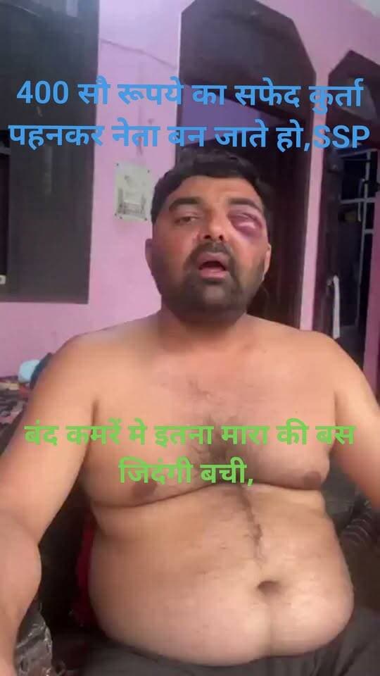 दिग्विजय भाटी और मोहित जाटव की पिटाई का आरोप। SSP पांडे ने अपने चैंबर में डेढ़ घंटे तक दलित नेता को पीटा
*"SSP के चैम्बर में 1.5 घंटे पीटा, SOG ऑफिस में बांधकर मारा इंस्पेक्टर अखिलेश गौड़ ने" - किसान नेताओं के साथ बर्बरता के आरोप*
मेरठ में दलित छात्रा ललिता गौतम मर्डर केस में हुए प्रदर्शन और लाठीचार्ज के मामले में 2 किसान नेताओं *दिग्विजय भाटी और मोहित जाटव* के साथ पुलिस हिरासत में बर्बरता का गंभीर आरोप लगा है।
*क्या है पूरा मामला?*
ललिता गौतम मर्डर केस में प्रदर्शन और लाठीचार्ज को लेकर दिग्विजय भाटी और मोहित जाटव को आरोपी बनाया गया था। सरकार के दखल के बाद मामला ठंडा पड़ा और दोनों की जमानत हो गई थी। सूत्रों के मुताबिक प्रदर्शन और लाठीचार्ज में दिग्विजय भाटी शामिल भी नहीं थे।
*किसान नेताओं ने क्या बताया?*
आरोप है कि कल *SSP ने दोनों को अपने ऑफिस में बुलाया*। पहले गालियां दीं, फिर अपने पर्सनल चैम्बर में बंद कर करीब *डेढ़ घंटे तक जूतों, घूसों और लातों से पीटा*।
इसके बाद दोनों को जिले की *SOG के हवाले* कर दिया गया। SOG ऑफिस में *इंस्पेक्टर अखिलेश गौड़* पर आरोप है कि उन्होंने दोनों के पैर बांधकर उल्टा लटकाया और *तलवों, कमर और पीठ पर फट्टों और लाठियों से पिटाई* की।
*सामने आए चोट के निशान*
आज सुबह दोनों से मुलाकात के बाद चोटों के निशान सामने आए। तस्वीरों में दिग्विजय भाटी की एक आंख पर गंभीर सूजन और चोट साफ देखी जा सकती है।
उधर रात ही मेरठ SSP को हटा दिया गया...