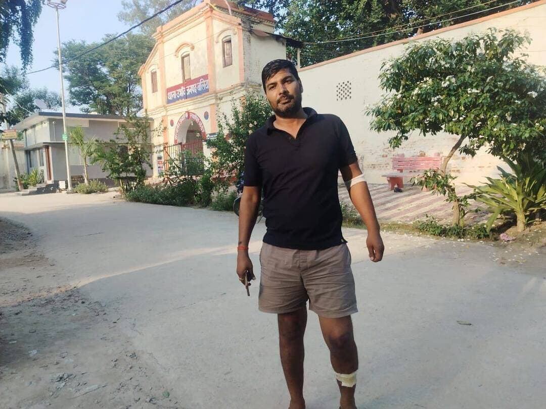 तहसील गेट के पास शराब कारोबारी पर चाकू-हथौड़े से जानलेवा हमला, रंगदारी मांगने का आरोप
बलिया। बेल्थरारोड तहसील गेट के पास बुधवार को शराब कारोबारी भानु प्रताप सिंह उर्फ बंटी सिंह पर हमलावरों ने चाकू, हथौड़े और कथित हथियार से हमला कर दिया। हमले में वह गंभीर रूप से घायल हो गए। प्राथमिक उपचार के बाद उन्हें सीयर सीएचसी से जिला अस्पताल रेफर किया गया।
गुरुवार को जिला अस्पताल में घायल बंटी सिंह का एक्सरे कराया गया। शाम करीब पांच बजे उभांव थाना के पास उन्होंने आरोप लगाया कि शराब कारोबार और प्रॉपर्टी डीलिंग के चलते उनसे रंगदारी की मांग की जा रही थी। उनका कहना है कि पूर्व में आर्थिक मदद देने के बावजूद दोबारा पैसा देने से इनकार करने पर उन पर हमला किया गया।
घायल कारोबारी ने दावा किया कि इससे पहले भी उन्हें तीन बार निशाना बनाया जा चुका है। घटना की सूचना मिलते ही डायल-112 पुलिस मौके पर पहुंची, लेकिन तब तक हमलावर फरार हो चुके थे।
बंटी सिंह ने आरोपियों के खिलाफ सख्त कार्रवाई की मांग की है। वहीं, पुलिस मामले की जांच में जुटी है और हमले के पीछे के कारणों तथा आरोपों की सत्यता की पड़ताल की जा रही है।
<nis:link nis:type=tag nis:id=ballianews nis:value=BalliaNews nis:enabled=true nis:link/> <nis:link nis:type=tag nis:id=belthararoad nis:value=BeltharaRoad nis:enabled=true nis:link/> <nis:link nis:type=tag nis:id=crimenews nis:value=CrimeNews nis:enabled=true nis:link/> <nis:link nis:type=tag nis:id=ubhavpolice nis:value=UbhavPolice nis:enabled=true nis:link/> <nis:link nis:type=tag nis:id=breakingnews nis:value=BreakingNews nis:enabled=true nis:link/>