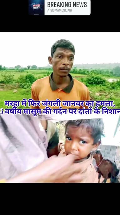 मरहा में फिर जंगली जानवर का हमला, 3 वर्षीय मासूम की गर्दन पर दांतों के निशान
शाहनगर। पन्ना जिले के शाहनगर क्षेत्र के ग्राम मरहा में जंगली जानवर के हमले की घटनाओं से ग्रामीणों में दहशत बढ़ती जा रही है। बीते दिन 5 वर्षीय बच्ची पर सियार के हमले के बाद आज शुक्रवार सुबह करीब 6 बजे उसी मोहल्ले में एक 3 वर्षीय मासूम बच्ची पर अज्ञात जंगली जानवर ने हमला कर दिया।
जानकारी के अनुसार, प्रियांशी उम्र 3 वर्ष सुबह घर के पास आंगन में थी।वहीं उसके पिता सुरेन्द्र सिंह और माता आशा बाई घर के अंदर थे। इसी दौरान अज्ञात जंगली जानवर ने बच्ची पर हमला कर दिया। बच्ची के चिल्लाने की आवाज सुनकर उसके पिता सुरेन्द्र सिंह दौड़कर मौके पर पहुंचे, लेकिन तब तक जानवर वहां से भाग चुका था।
हमले में बच्ची की गर्दन पर जानवर के दांतों के निशान बताए जा रहे हैं। घटना के बाद परिजन बच्ची को उपचार के लिए ले गए।वहीं घटना की सूचना वन विभाग को दे दी गई है।
लगातार दो दिनों में एक ही मोहल्ले में दो मासूम बच्चियों पर जंगली जानवर के हमले की घटना सामने आने से ग्रामीणों में भय का माहौल है। ग्रामीणों ने वन विभाग से क्षेत्र में तत्काल गश्त बढ़ाने और हमलावर जंगली जानवर की पहचान कर उसे आबादी क्षेत्र से दूर करने की मांग की है। Dfo South Panna Collector Office Panna #शाहनगर #पन्ना #मरहा #जंगलीजानवर #वनविभाग