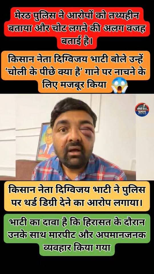 मेरठ में पुलिस पर गंभीर आरोप!
किसान नेता दिग्विजय भाटी ने मेरठ पुलिस पर हिरासत के दौरान मारपीट और कथित थर्ड डिग्री देने के गंभीर आरोप लगाए हैं। भाटी का दावा है कि उन्हें अपमानित करते हुए ‘चोली के पीछे क्या है’ गाने पर डांस करने के लिए मजबूर किया गया। उन्होंने तत्कालीन SSP अविनाश पांडेय और SOG इंस्पेक्टर अखिलेश गौड़ पर दुर्व्यवहार व मारपीट के आरोप लगाए हैं।
वहीं, मेरठ पुलिस ने आरोपों को तथ्यहीन और निराधार बताते हुए दावा किया है कि दिग्विजय भाटी और मोहित जाटव स्कूटी फिसलने से घायल हुए थे। मामले में निष्पक्ष जांच और पुलिसकर्मियों की भूमिका पर कार्रवाई की मांग उठ रही है।
#Meerut #UPNews #Police #DigvijayBhati #UttarPradesh #BreakingNews