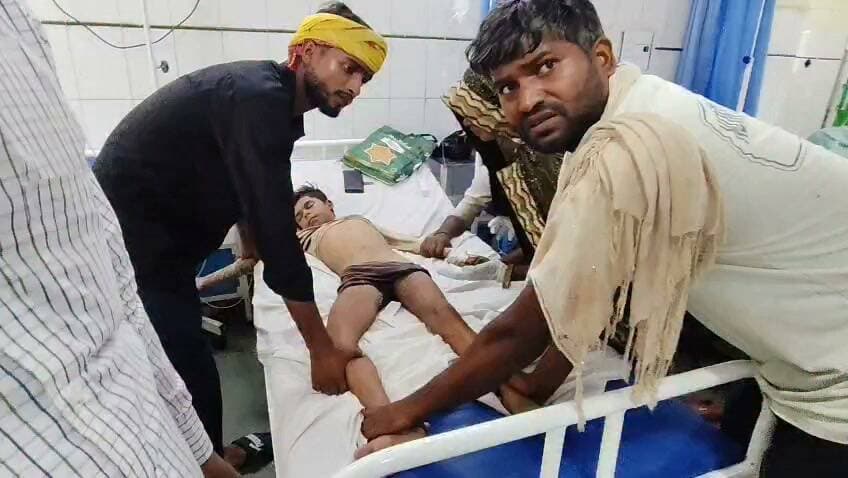 चित्रकूट पहाड़ी के सिकरिया गांव में बंदर भागते समय तीन सेट में उतर रहे करंट की चपेट में आने से 11 वर्षी बालक झुलसा जिला अस्पताल रेफर। मामला चित्रकूट जनपद के पहाड़ी थाना क्षेत्र के सिकरिया गांव का आज शुक्रवार की सुबह लगभग 10:00 बजे का है जहां करंट की चपेट में आने से 11 वर्षी बालक के झुलस गया 11 वर्षी बालक दीपक पुत्र राम विशाल के परिजनों ने बताया कि दीपक अपने घर में लगे टीन शेड के ऊपर बैठे बंदरों को भगा रहा था तभी तीन सेड में बिजली की तार टच होने पर टीन सेड में करंट उतर रहा था बंदर भागते समय दीपक ने तीन सेट को छू लिया जिससे उसे करंट लग गया और वह गंभीर रूप से झुलस गया वही परिजन किसी तरह से दीपक को करंट से छुड़ाकर पहाड़ी सामुदायिक स्वास्थ्य केंद्र लेकर पहुंचे हैं जहां से दीपक को जिला अस्पताल रेफर किया गयाnहै