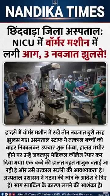 छिंदवाड़ा NICU हादसा: वॉर्मर मशीन में स्पार्किंग से आग, 3 मासूम झुलसे! 🚨 #shorts #breakingnews