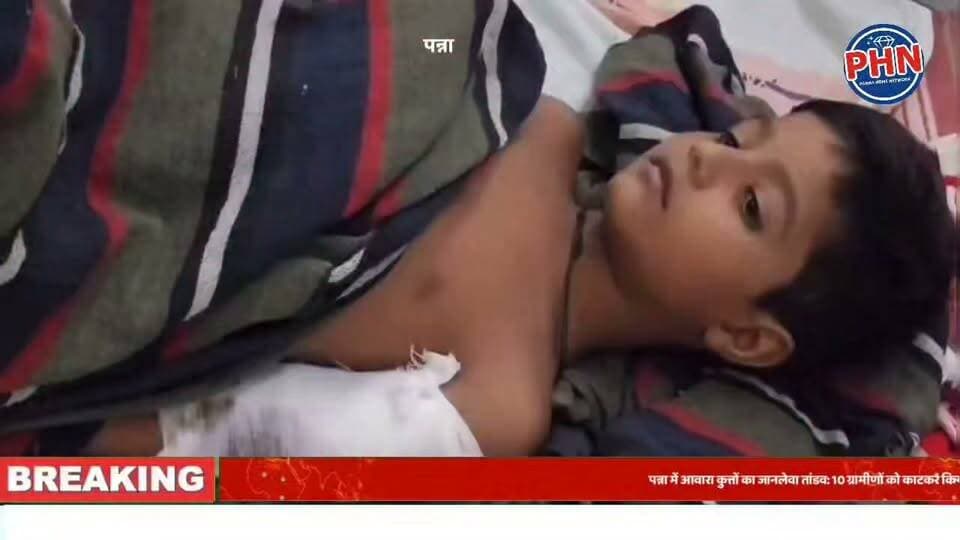 पन्ना में आवारा कुत्तों का जानलेवा तांडव: 10 ग्रामीणों को काटकर किया लहूलुहान, गांव में भारी दहशत।