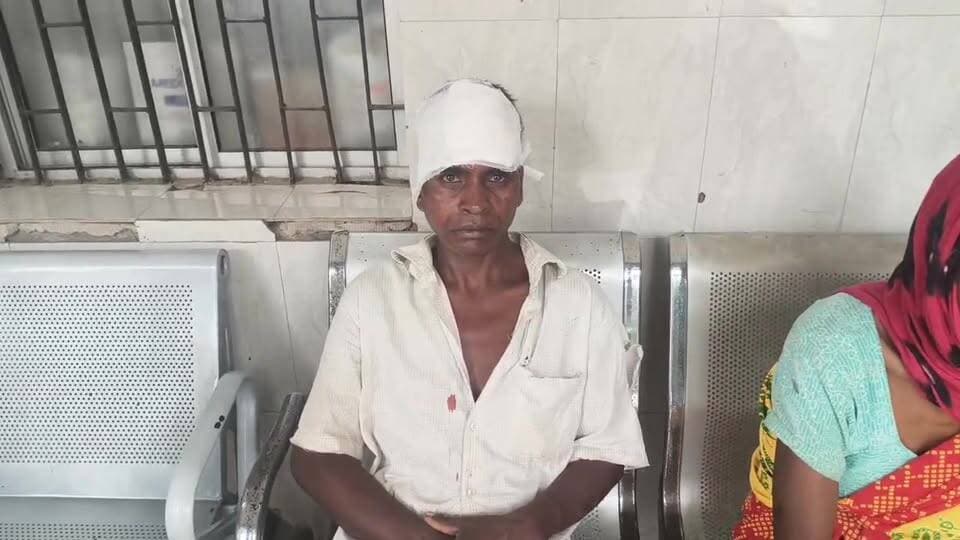 भालू के हमले में ग्रामीण गंभीर घायल, एंबुलेंस सुविधा नहीं मिलने पर घंटों बाद पहुंचे सदर अस्पताल