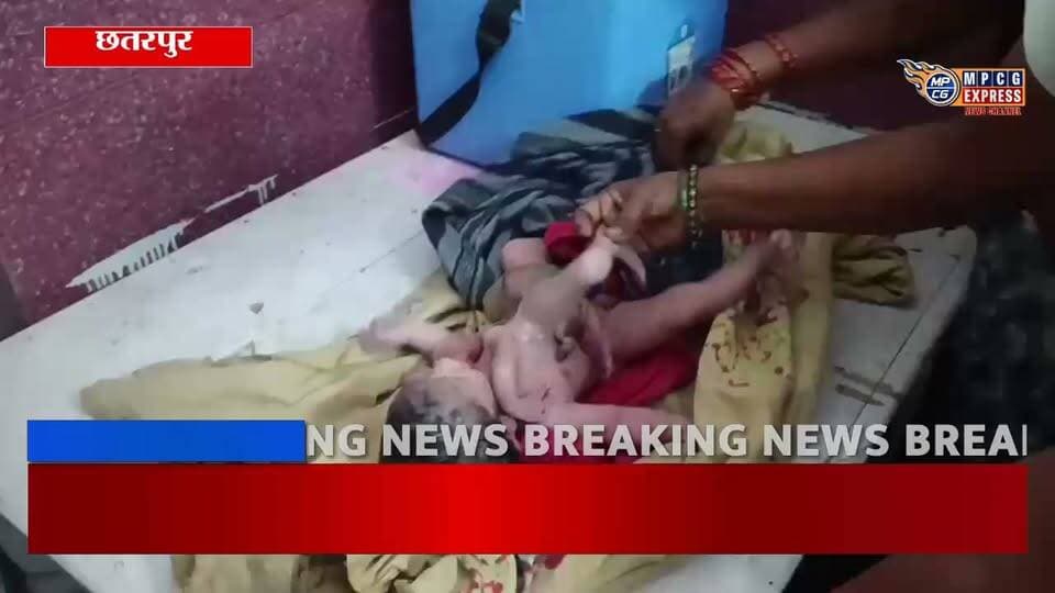 छतरपुर में अनोखा जन्म, महिला ने दिया 4 हाथ और 4 पैर वाले बच्चे को जन्म