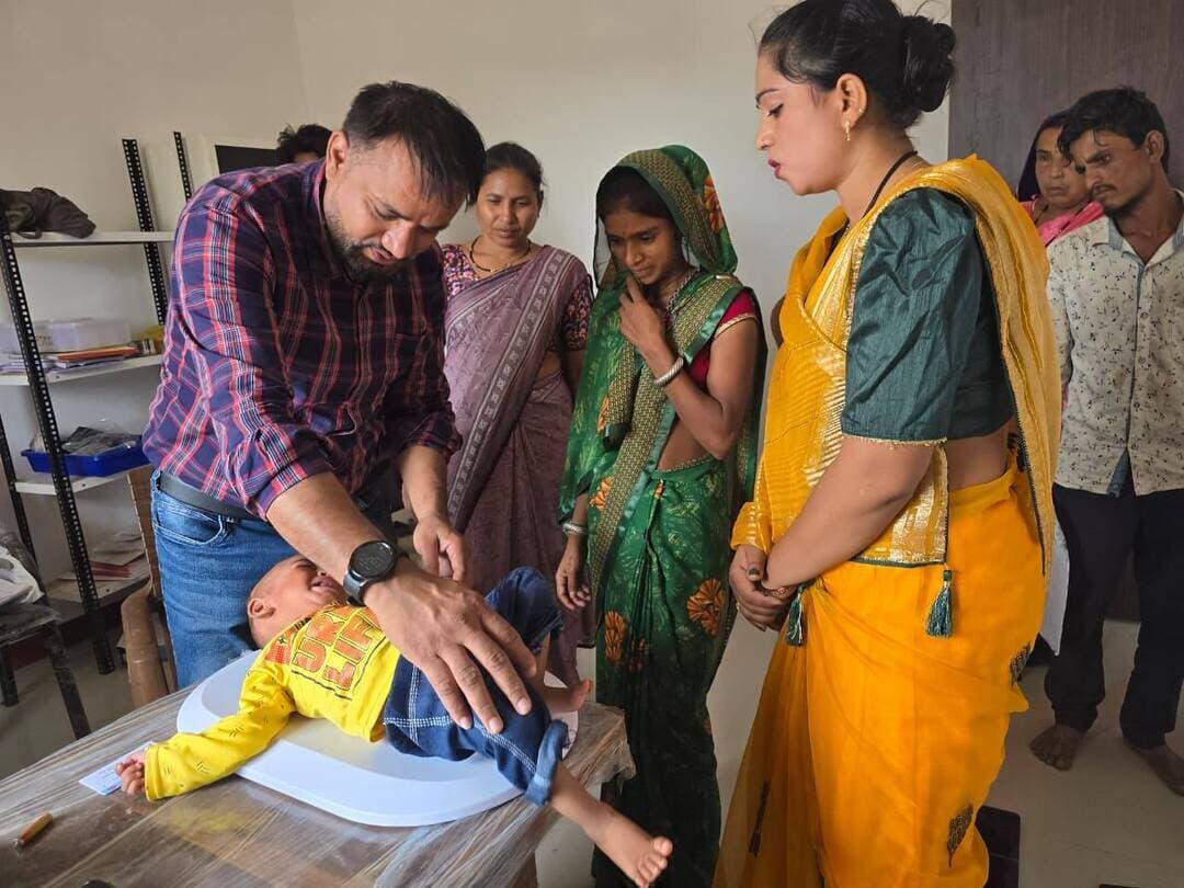 *जिले में 'मिशन पोषण ज्योति' के तहत 2384 अति कुपोषित बच्चों का स्वास्थ्य परीक्षण, उपचार और पोषण प्रबंधन जारी*
बड़वानी 23 अगस्त 2026/कलेक्टर श्रीमती जयति सिंह के कुशल मार्गदर्शन में जिला प्रशासन, स्वास्थ्य विभाग एवं महिला एवं बाल विकास विभाग के संयुक्त तत्वावधान में 'मिशन पोषण ज्योति अभियान' का सफलतापूर्वक संचालन किया जा रहा है। अभियान के तहत जिले के चिन्हांकित 2384 अति कुपोषित (सैम) बच्चों का राष्ट्रीय बाल स्वास्थ्य कार्यक्रम (आरबीएसके) के अंतर्गत स्वास्थ्य परीक्षण कर आवश्यकतानुसार उपचार और विशेष पोषण आहार उपलब्ध कराया जा रहा है।
जांच के दौरान 1724 अति कुपोषित बच्चों में विभिन्न स्वास्थ्य समस्याएं एवं बीमारियां चिन्हांकित की गईं, जिनका त्वरित उपचार सुनिश्चित किया गया है:
• अंडरन्यूट्रिशन - कुपोषण से ग्रसित कुल 472 बच्चों को महिला एवं बाल विकास विभाग द्वारा विशेष पोषण आहार दिया जा रहा है।
• कम वजन वाले बच्चे - 42 बच्चों को स्वास्थ्य विभाग द्वारा पोषण पुनर्वास केंद्र (एनआरसी) में उपचारित करने के पश्चात उचित आहार प्रबंधन से जोड़ा गया है।
• एनोरेक्सिया- भूख न लगने की समस्या से पीड़ित 68 बच्चों को भूख बढ़ाने की दवा/सिरप प्रदान की गई।
• डिहाइड्रेशन: निर्जलीकरण से ग्रसित 25 बच्चों का आरबीएसके टीम द्वारा मौके पर ही ओआरएस एवं आवश्यक दवाएं देकर उपचार किया गया।
• सिकल सेल एनीमिया: 19 बच्चों में पुष्टि होने पर उन्हें हाइड्रोक्सीयूरिया, आईएफए एवं अन्य दवाएं दी जा रही हैं।
• टी.बी. : टीबी से ग्रसित 10 बच्चों का डॉट्स (DOTS) श्रेणी के अंतर्गत उपचार जारी है।
• सामान्य एनीमिया: 116 बच्चों में खून की कमी पाई गई, जिनका इलाज स्वास्थ्य विभाग द्वारा किया जा रहा है।
• बाल हृदय रोग: 03 बच्चों में हृदय रोग के लक्षण मिले, जिनमें से 02 बच्चों की इको जांच सामान्य रही तथा 01 बच्चे की 'मुख्यमंत्री बाल हृदय उपचार योजना' के तहत सफल सर्जरी कराई गई।
• डेवलपमेंटल डिले : विकास संबंधी देरी का सामना कर रहे 08 बच्चों का स्वास्थ्य विभाग द्वारा उपचार व थेरेपी दी जा रही है।
विभागों में बेहतर समन्वय स्थापित कर अभियान की प्रगति की नियमित समीक्षा की जा रही है। कुपोषण के मूल कारणों पर प्रहार करते हुए बच्चों के अभिभावकों की हर स्तर पर काउंसलिंग की जा रही है, जिससे बच्चों के स्वास्थ्य सुधार में अभूतपूर्व प्रगति देखने को मिल रही है।
अभियान मे विशेष रूचि लेते हुये स्वास्थ्य विभाग एवं महिला एवं बाल विकास विभाग में समन्वय स्थापित कर, नियमित रूप से अभियान की प्रगति की समीक्षा कर एवं कुपोषण के कारणों की जड़ पर कार्य कर बड़वानी, जिले को कुपोषण के विरूध्द इस निर्णायक कदम को बढ़ाने में अहम भूमिका निभाई गई।