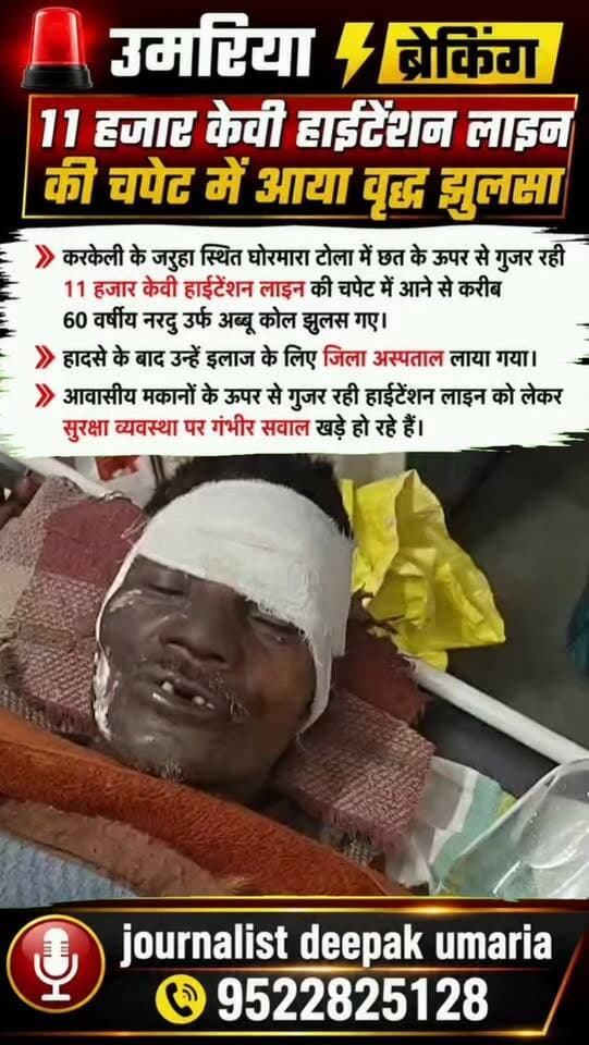 ⚡ उमरिया ब्रेकिंग | हाईटेंशन लाइन की चपेट में वृद्ध
करकेली के जरहा स्थित घोरमारा टोला में छत के ऊपर से गुजर रही 11 हजार केवी हाईटेंशन लाइन की चपेट में आने से करीब 60 वर्षीय नरदु उर्फ अब्बू कोल झुलस गए। उन्हें इलाज के लिए जिला अस्पताल लाया गया।
आवासीय मकानों के ऊपर से गुजर रही हाईटेंशन लाइन ने सुरक्षा व्यवस्था पर गंभीर सवाल खड़े कर दिए हैं।
आपके क्षेत्र में सड़क, बिजली, पानी, शिक्षा या किसी भी तरह की समस्या है? हमें जरूर बताएं। आपकी आवाज जिम्मेदारों तक पहुंचाना हमारी जिम्मेदारी है।
#उमरिया #करकेली #UmariaNews #BreakingNews #MPNews MadhyaPradesh HighTensionLine ElectricShock जनसमस्या जनता कीआवाज JournalistDeepak