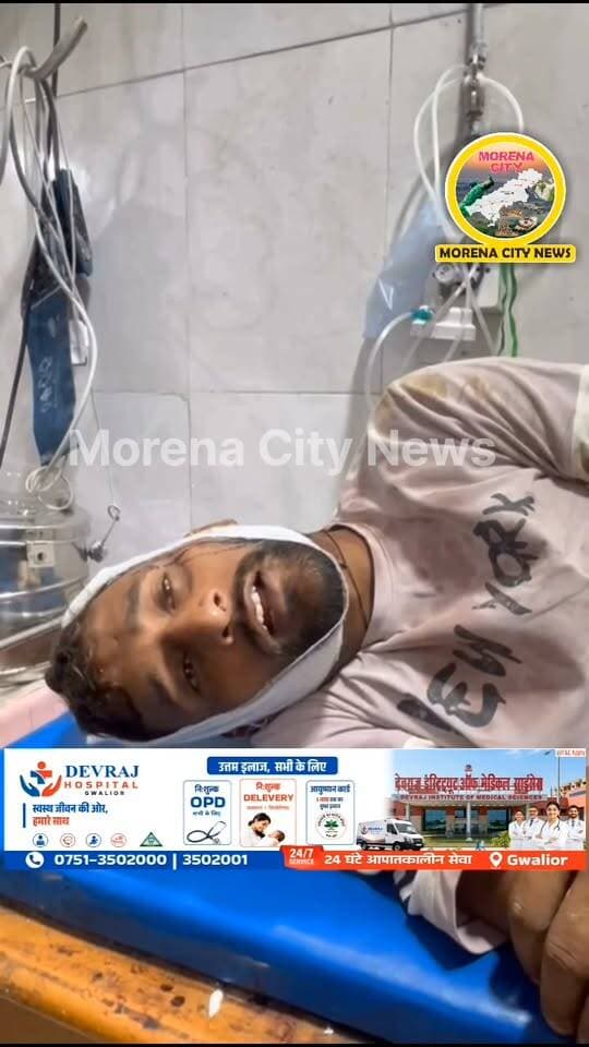 कैमरा गांव में रास्ते को लेकर दो पक्ष भिड़े, जमकर चलीं लाठियां, बाइक और दूध की टंकियां भी तोड़ीं
मुरैना। सरायछोला थाना क्षेत्र के कैमरा गांव में रास्ता निकलने को लेकर हुए विवाद में एक दूधिया के साथ मा.रपीट का मामला सामने आया है। आरोप है कि गांव के ही कुछ लोगों ने रास्ते में घेरकर लाठी-डंडों से हमला कर दिया। इस दौरान सिर में फरसा लगने से राम रहीश गुर्जर गंभीर रूप से घायल हो गए।
जानकारी के अनुसार, कैमरा गांव निवासी राम रहीश गुर्जर बाइक से जारह गांव स्थित डेयरी पर दूध देने जा रहे थे। इसी दौरान रास्ते में गांव के ही दीपू गुर्जर फौजी, सहदेव, बांके, राजेश और मुकेश ने उन्हें घेर लिया और लाठियों से मारपीट शुरू कर दी। आरोप है कि मा.रपीट के दौरान बांके ने फा.यरिंग कर दहशत फैलाई, जबकि फरसा लगने से राम रहीश के सिर में गंभीर चोट आई।
घायल राम रहीश को उपचार के लिए जिला अस्पताल में भर्ती कराया गया है। घटना की सूचना मिलने के बाद सरायछोला थाना पुलिस मामले की जांच में जुट गई है।
हालांकि पुलिस ने फायरिंग की पुष्टि नहीं की है। सरायछोला थाना प्रभारी एसआई केके सिंह ने बताया कि दोनों पक्षों के बीच विवाद हुआ है और दोनों तरफ से लोग घायल हुए हैं। लाठियां चलने की बात सामने आई है, लेकिन किसी भी पक्ष की ओर से फायरिंग की जानकारी नहीं दी गई है। मामले में नियमानुसार कार्रवाई की जा रही है।
#मुरैना #morena #पुलिस