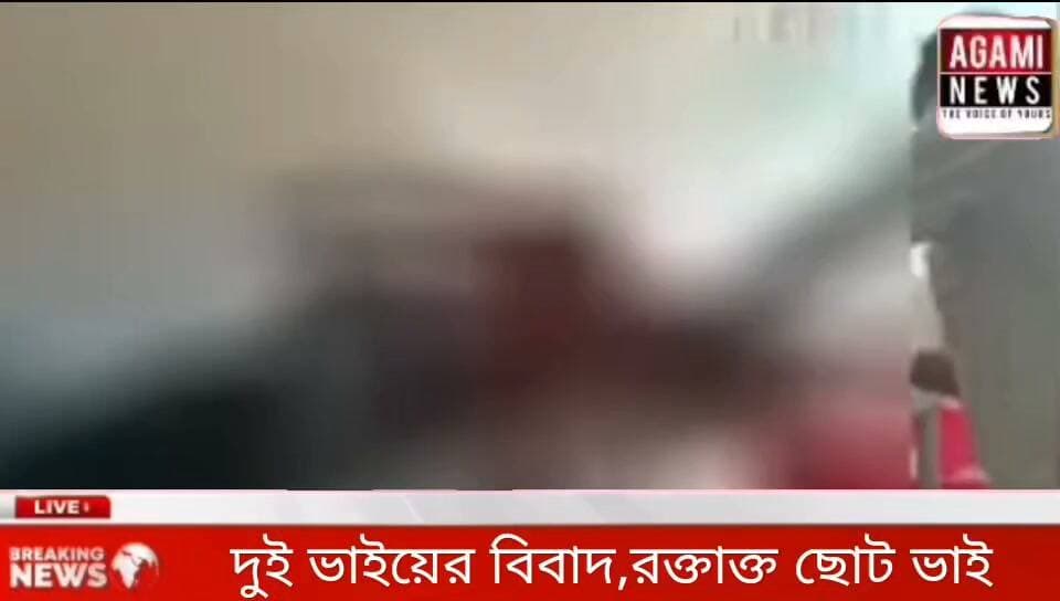 সাত সকালে দুই ভাইয়ের ঝামেলা,রক্তাক্ত ছোট ভাই