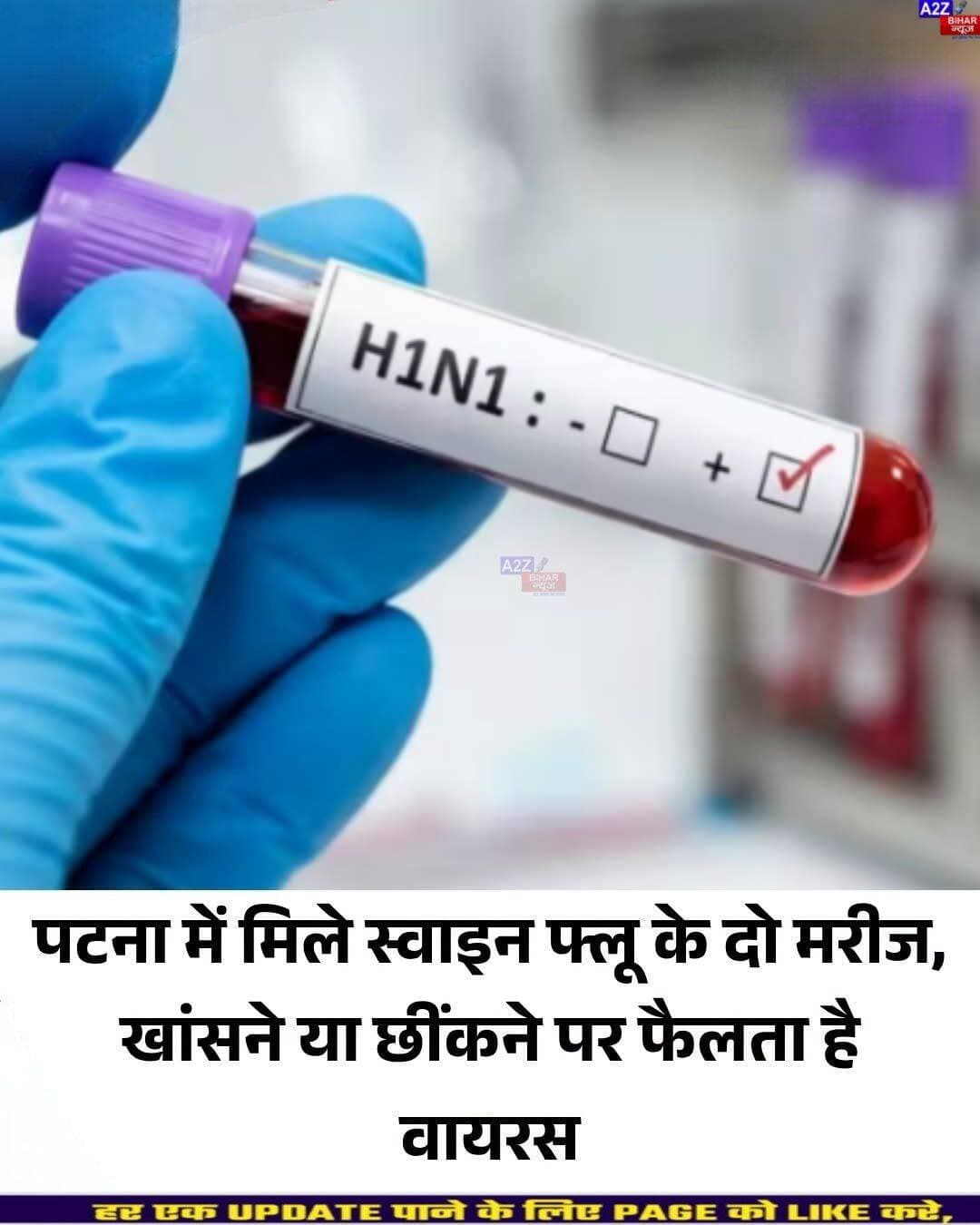 <nis:link nis:type=tag nis:id=पटना nis:value=पटना nis:enabled=true nis:link/> में स्वाइन फ्लू की दस्तक, H1N1 के 2 मरीज मिले; दिल्ली से लौटने के बाद बिगड़ी तबीयत...SeeMore