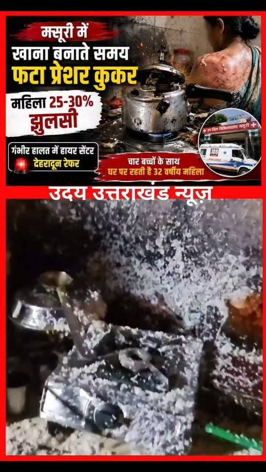 मसूरी में खाना बनाते समय फटा प्रेशर कुकर!
बारहकैंची में हुए हादसे में 32 वर्षीय महिला गौरी 25–30% झुलस गईं। गंभीर हालत में उप जिला अस्पताल से देहरादून हायर सेंटर रेफर किया गया। महिला अपने चार बच्चों के साथ रहती हैं।
#Mussoorie #BreakingNews #PressureCookerBlast #UttarakhandNews #Dehradun NewsUpdate
