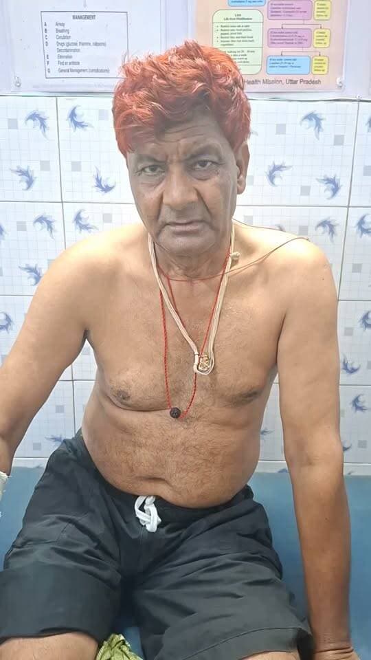 🚨 जसवंतनगर में सांड का आतंक! शिक्षक को पटक-पटककर किया घायल
📍 ग्राम धरवार : स्कूल परिसर में मवेशियों को चारा खिला रहे शिक्षक प्रमोद कुमार पर अचानक हमलावर सांड ने हमला कर दिया। शिक्षक ने सांड को भगाने की कोशिश की तो उसने उन्हें जमीन पर पटक दिया और सींगों से कई बार हमला कर बुरी तरह घायल कर दिया।
🩺 परिजन शनिवार सुबह घायल शिक्षक को सामुदायिक स्वास्थ्य केंद्र जसवंतनगर लेकर पहुंचे, जहां उनका उपचार किया गया।
ग्रामीणों के अनुसार यह सांड पहले भी पवन जैन और संतोष सविता समेत कई लोगों को घायल कर चुका है। ग्रामीणों का आरोप है कि कई बार शिकायत के बावजूद प्रशासन की ओर से समस्या का समाधान नहीं किया गया।
⚠️ ग्रामीणों में भारी आक्रोश है। लोगों ने प्रशासन से सांड को तत्काल पकड़वाकर सुरक्षित स्थान पर भेजने की मांग की है।
👉 क्या आपके क्षेत्र में भी आवारा पशुओं का ऐसा आतंक है? कमेंट में बताएं।
#जसवंतनगर #इटावा #DPSChannel #आवारा_सांड #स्थानीय_समाचार