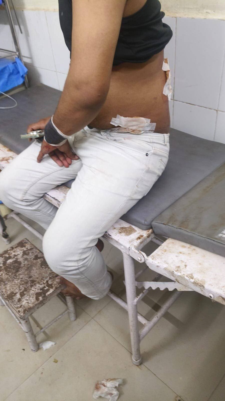आकोला में हुई चाकू बाजी की घटना
आचार संहिता के साये में भी हो गई वारदात।
दैनिक वीरधरा राजस्थान
आकोला। आकोला में चाकूबाजी के आरोपी ने 12 घंटे में फिर किया हमला, ग्रामीणों ने दबोचकर पुलिस को सौंपा।
आकोला थाना क्षेत्र में बेखौफ बदमाशों का दुस्साहस सामने आया है। शनिवार शाम आकोला में चाकूबाजी की वारदात को अंजाम देकर फरार हुए आरोपी ने ठीक 12 घंटे बाद रविवार सुबह दूसरी वारदात कर दी। कपासन तहसील के हमेरपुरा (करूकड़ा पंचायत) में मुंह बांधकर बैठे आरोपी से पूछताछ करने पर ग्रामीणों पर ही चाकू से हमला कर दिया। हालांकि, ग्रामीणों की सतर्कता और हिम्मत से आरोपी का पीछा कर दबोच लिया गया और पुलिस के हवाले कर दिया।
पहली वरदात में शनिवार शाम 7:30 बजे आकोला में आरोपी हिमांशु पिता गणपत यादव ने एक युवक पर चाकू से हमला किया और मौके से गायब हो गया। पुलिस रातभर अलग अलग ठिकानों पर दबिश देती रही, लेकिन वह हत्थे नहीं चढ़ा।
दूसरी वारदात रविवार सुबह 7:30 बजे आरोपी भागकर हमेरपुरा गांव पहुंचा और एकांत में मुंह पर कपड़ा बांधकर बैठ गया, संदिग्ध हालत में देखकर जब गांव के लोगों ने उससे नाम और वहां बैठने का कारण पूछा तो वह आपा खो बैठा और उसने जेब से चाकू निकालकर ग्रामीणों पर हमला कर दिया।
करूकड़ा सरपंच रामेश्वर लाल जाट ने बताया कि आरोपी के अचानक किए हमले में हमेरपुरा निवासी बोथमल जाट पिता माधु लाल जाट, सुरेश जाट और उनकी माताजी घायल हो गए। हमले में बोथमल जाट गंभीर रूप से जख्मी हुए हैं, जिन्हें स्थानीय अस्पताल में प्राथमिक उपचार के बाद तुरंत उदयपुर रेफर कर दिया गया।
दूसरी बार चाकूबाजी कर भाग रहे हिमांशु को देखकर ग्रामीणों ने शोर मचाया और एकजुट होकर उसका पीछा किया, हिंगवानिया गांव के पास ग्रामीणों ने उसे चारों तरफ से घेरकर दबोच लिया। सूचना मिलते ही आकोला थाना पुलिस मौके पर पहुंची, जिसके बाद ग्रामीणों ने आरोपी को पुलिस को सौंप दिया।